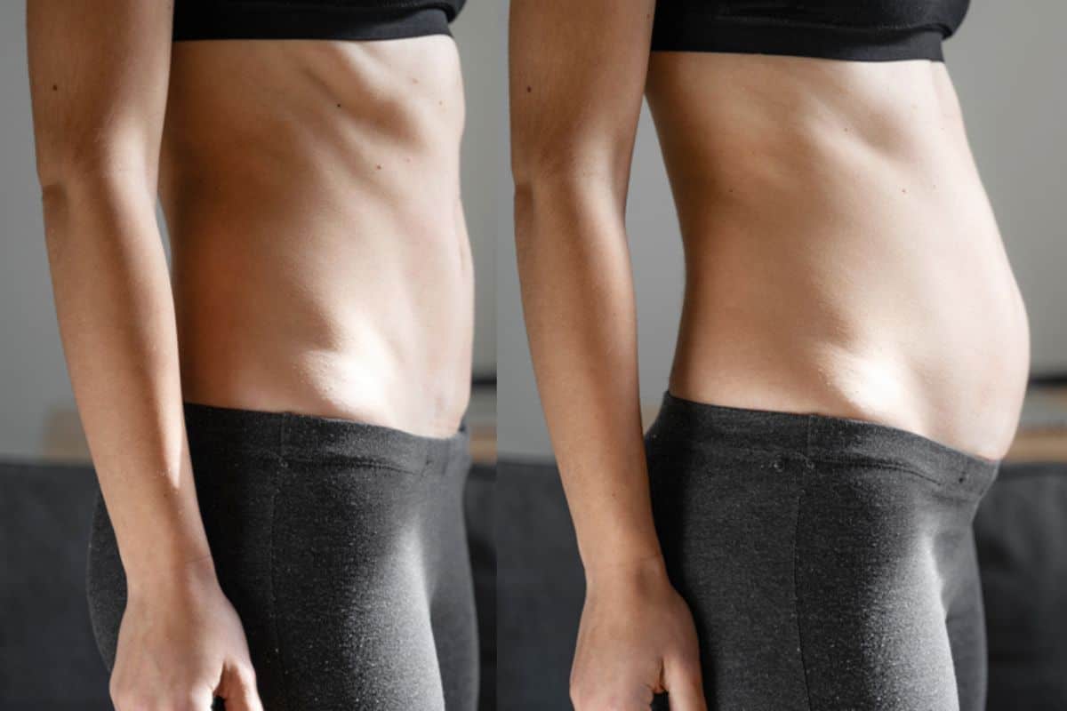 How long does diastasis recti take to improve Salford?