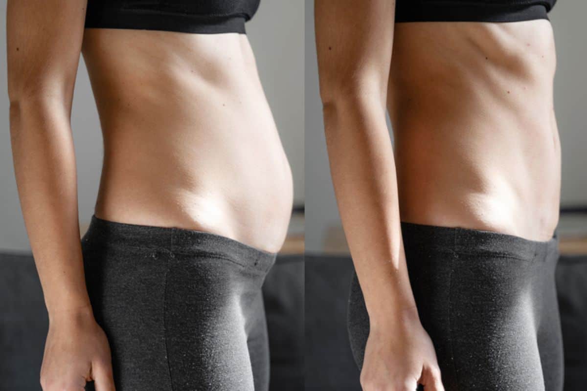 Post-Pregnancy: What Happens to Your Abdominal Muscles After Birth Salford
