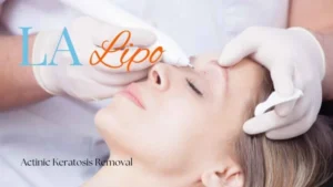 Woman receiving Actinic Keratosis Removal Treatment Salford