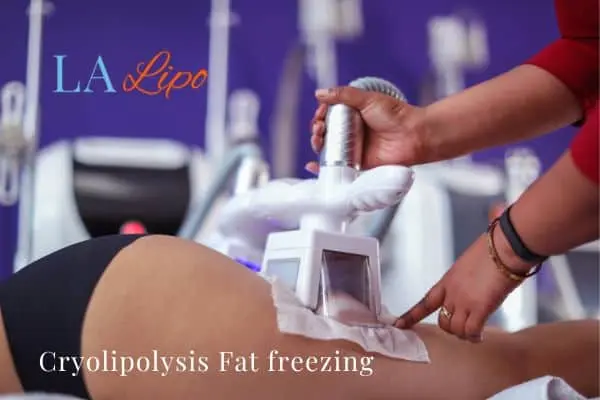 women getting fat freezing Salford