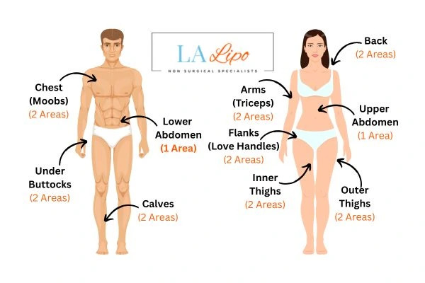LA LIPO Cryolipolysis Areas Salford