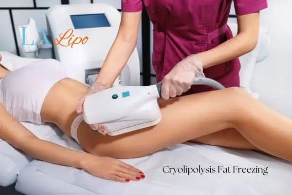 Woman receiving coolsculpting Salford treatment on her thighs