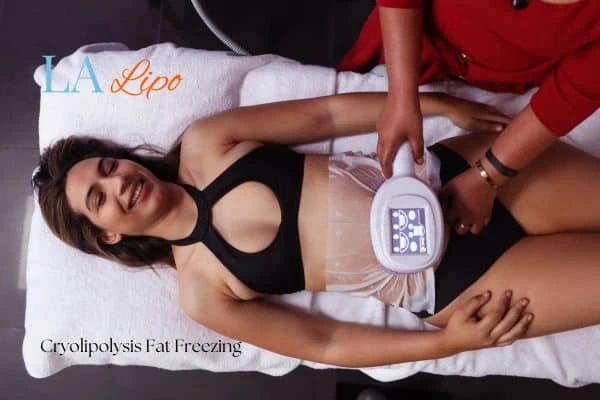 woman getting cryolipolysis Salford