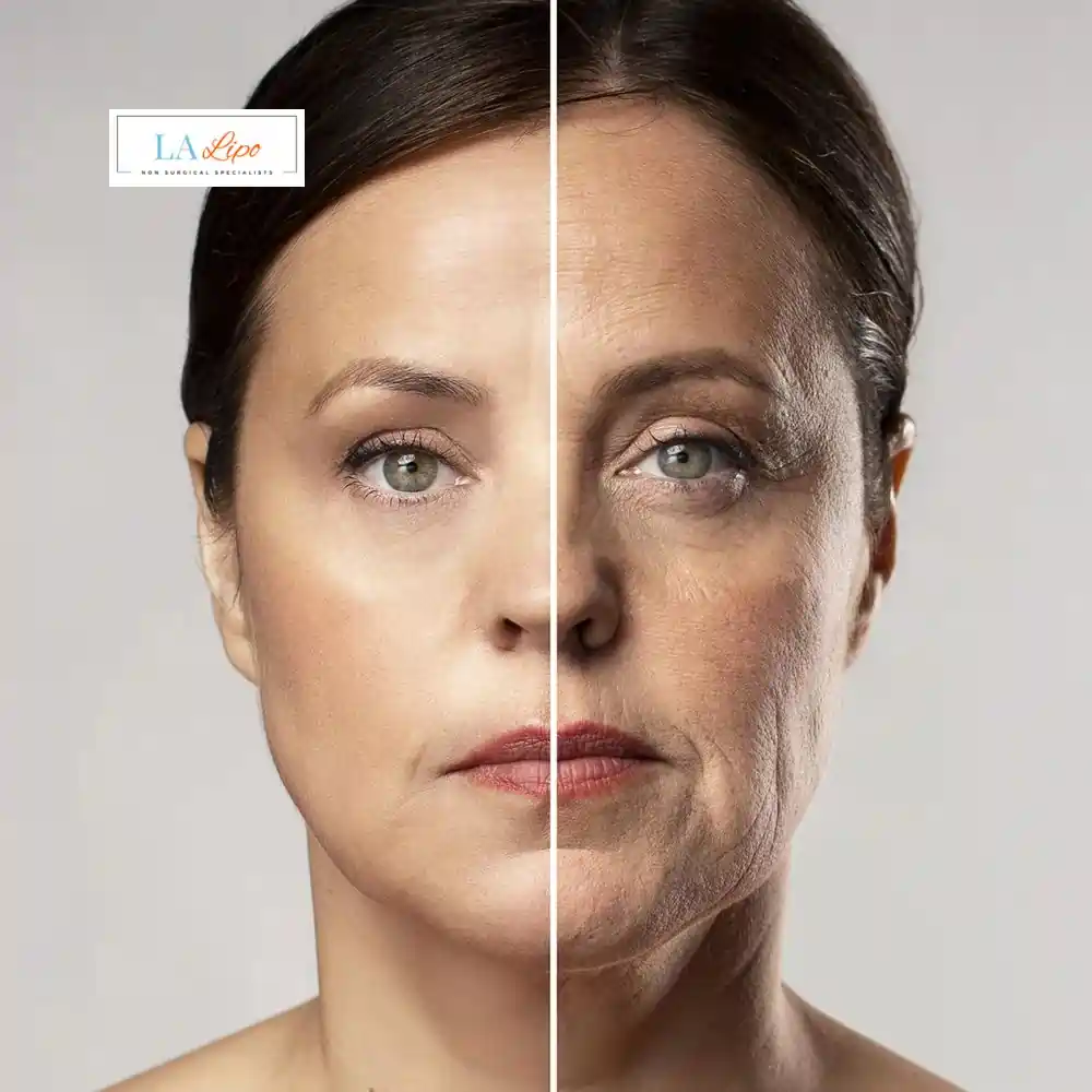 How Can You Tell If Non-Surgical Skin Tightening Is Right for You Salford?