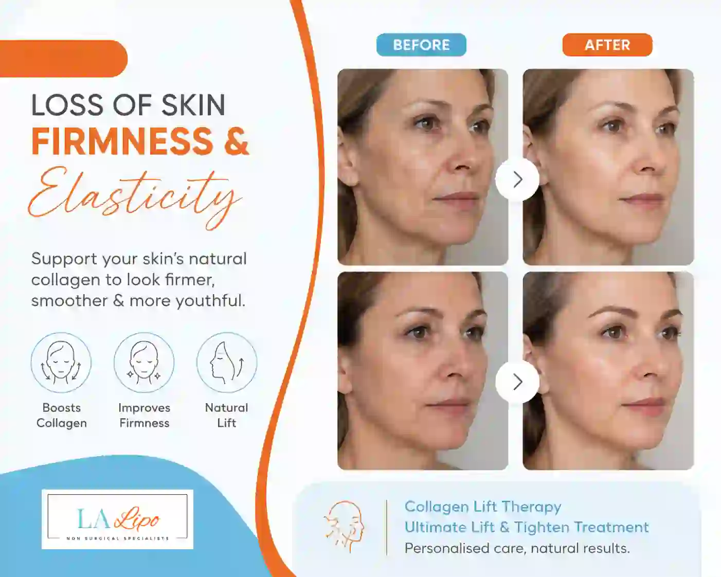 Sign #7: Loss of Skin Firmness and Elasticity Salford